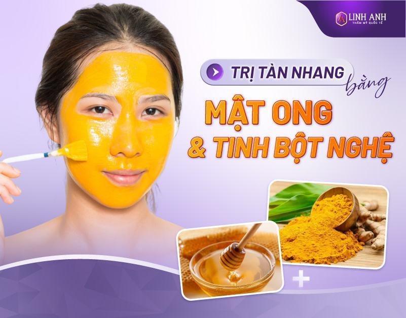 cách trị tàn nhang bằng mật ong và trứng gà