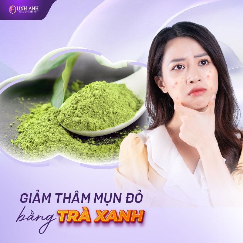 cách trị mụn thâm đỏ cách trị thâm đỏ 2 bên má