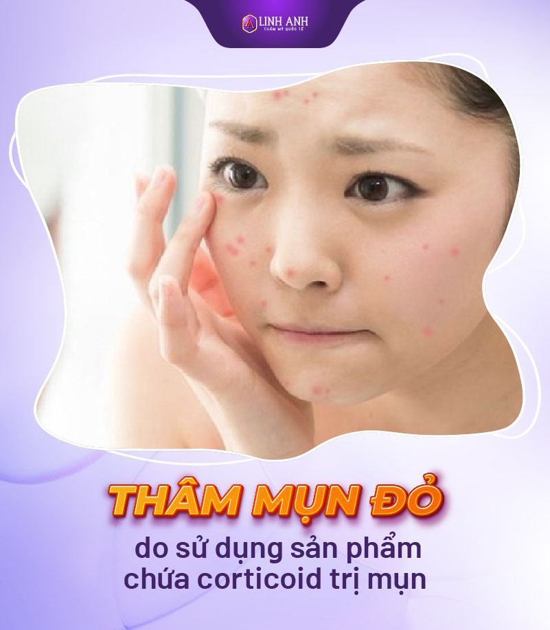 cách trị mụn thâm đỏ tại nhà cách trị thâm mụn đỏ