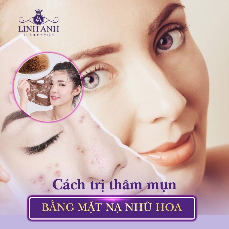 cách trị thâm mụn đơn giản