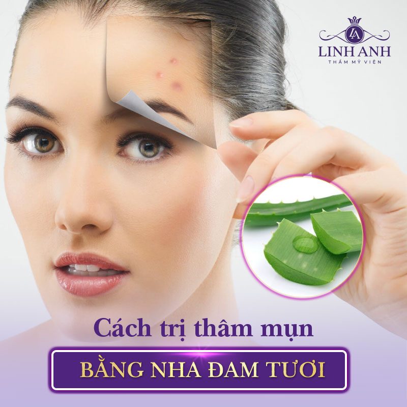 cách trị thâm mụn hiệu quả