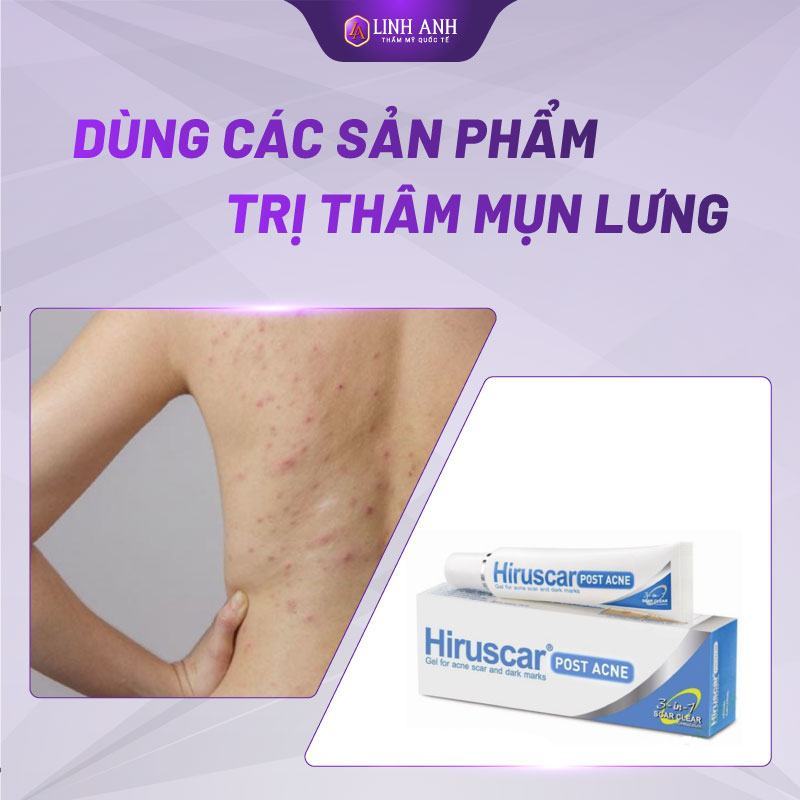 cách trị thâm mụn lưng cách trị thâm mụn lưng