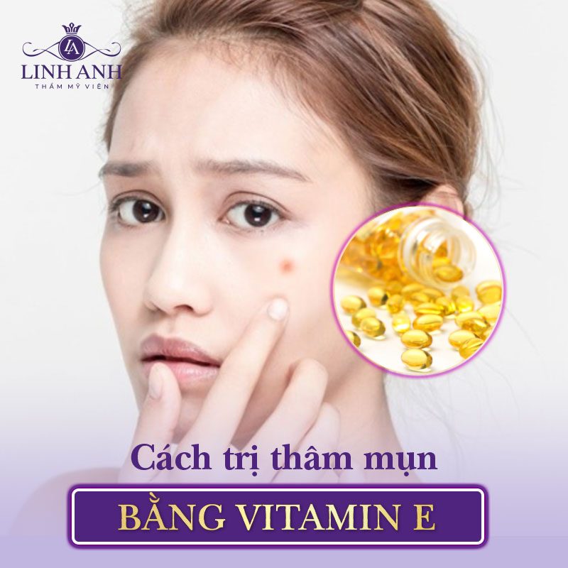 cách trị thâm mụn tại nhà đơn giản nhất