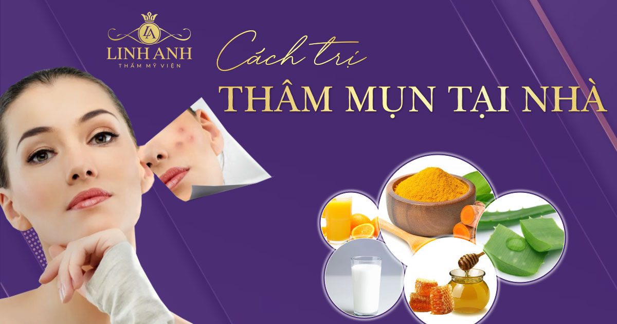 cách trị thâm mụn tại nhà