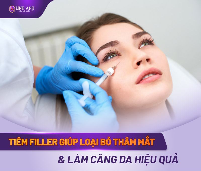 cách trị thâm quầng mắt lâu năm