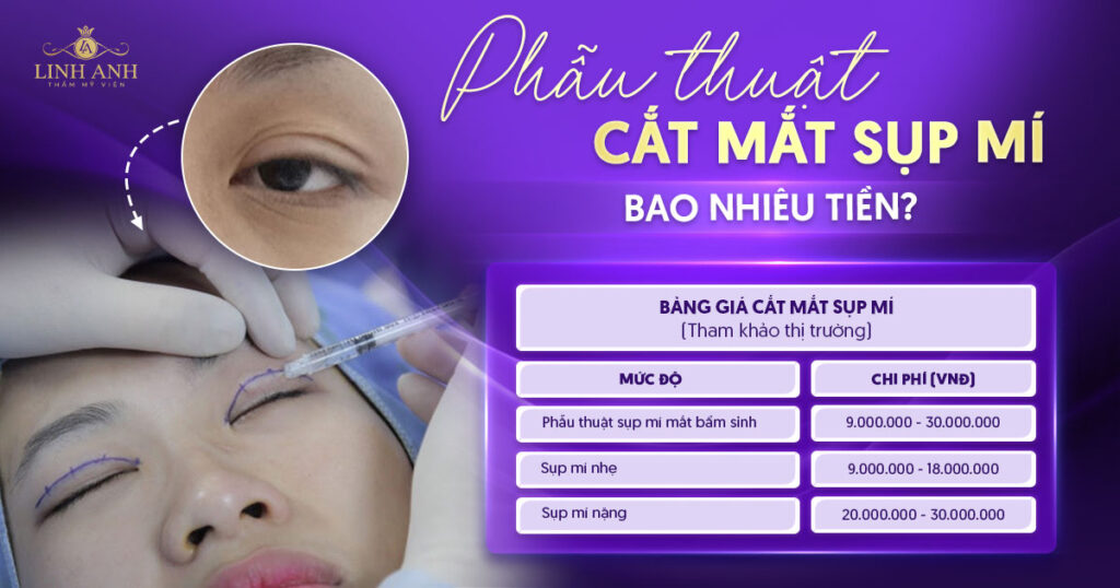 cắt mắt sụp mí bao nhiêu tiền
