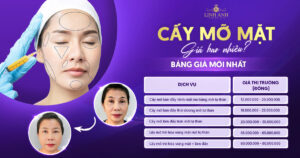 cấy mỡ mặt giá bao nhiêu