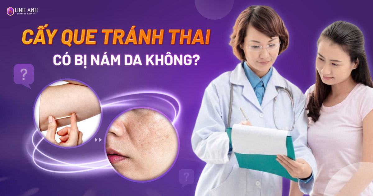 Cấy que tránh thai có bị nám da không? Có tác dụng phụ không?