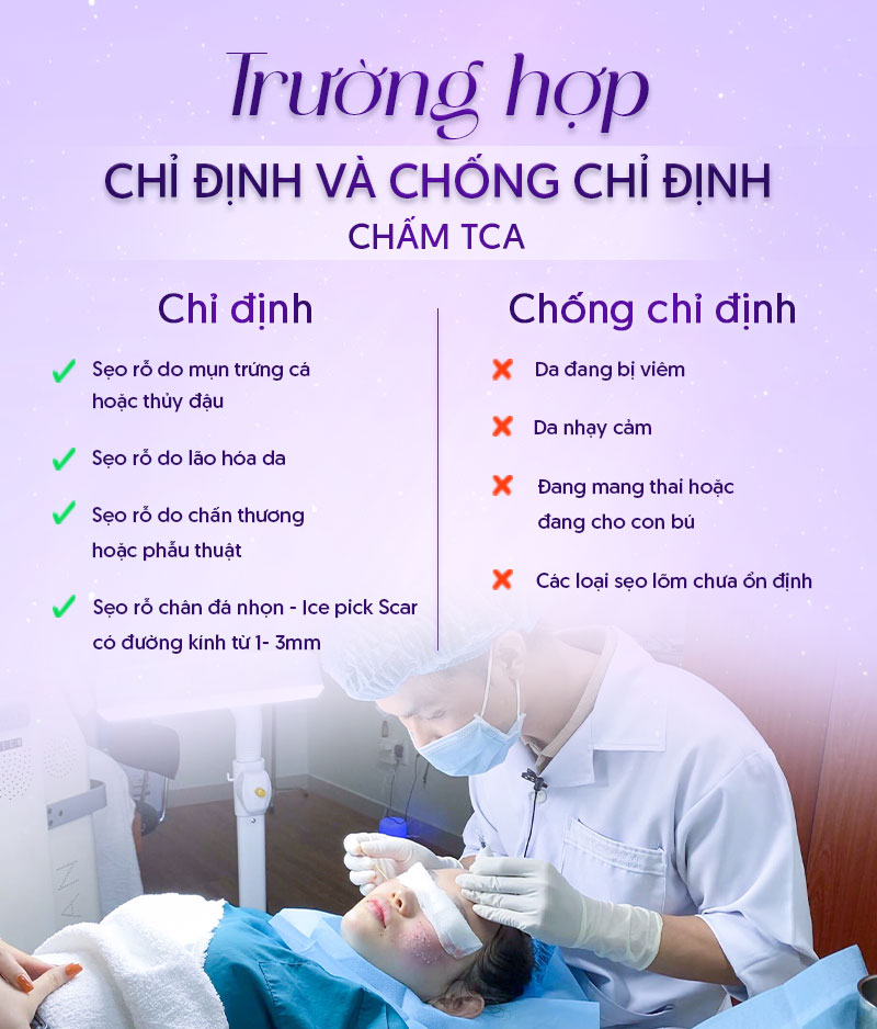 chấm tca bao nhiêu tiền chấm tca bao nhiêu tiền