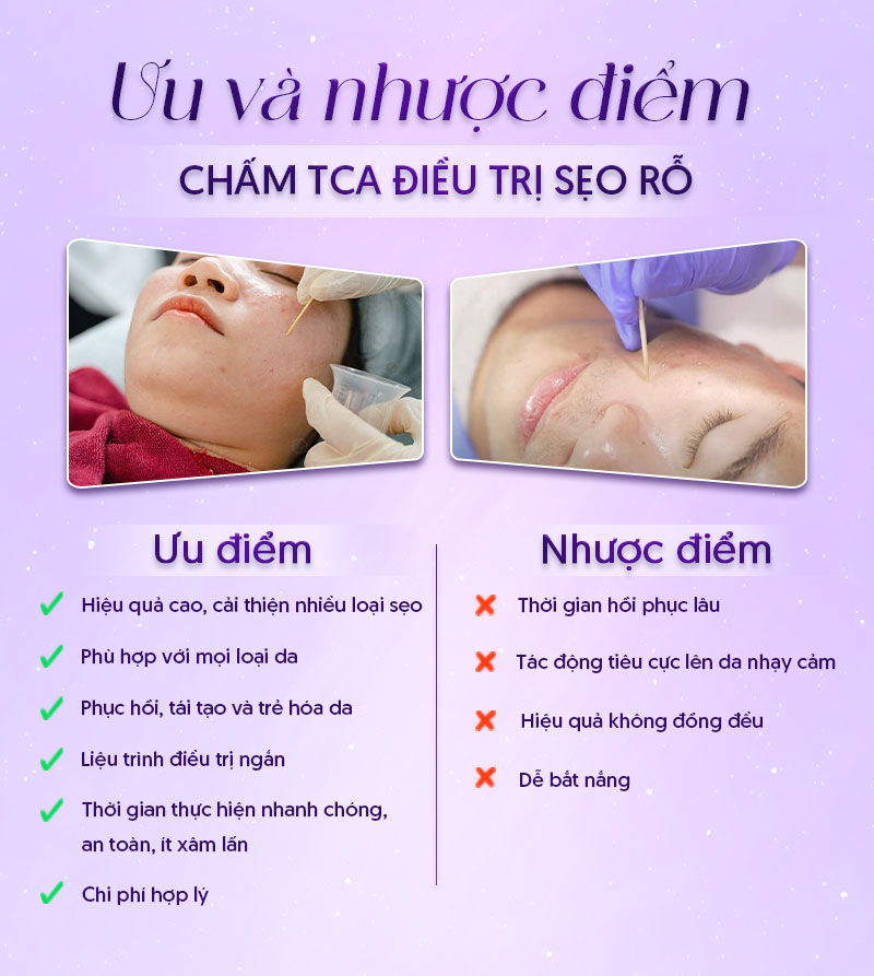 chấm tca trị sẹo rỗ bao nhiêu tiền chấm tca trị sẹo rỗ bao nhiêu tiền