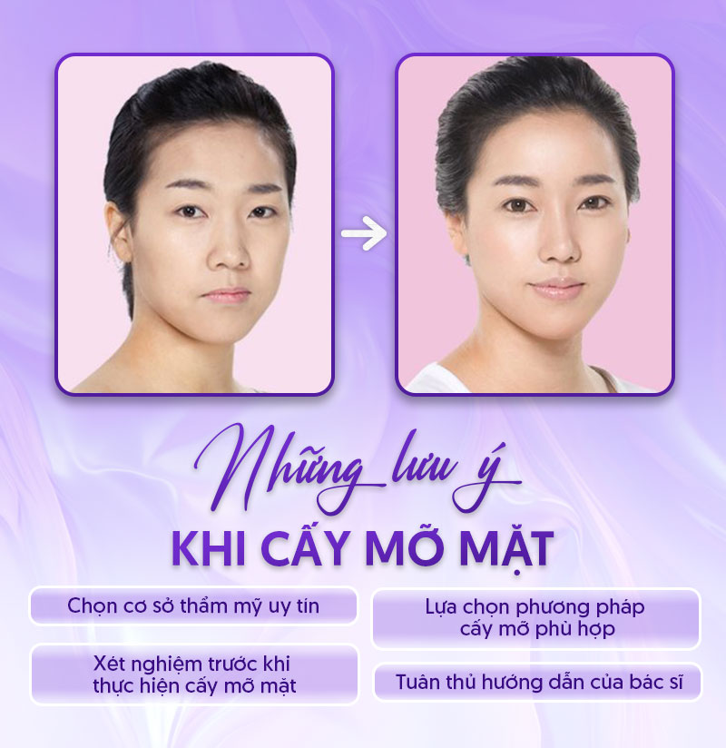 chi phí cấy mỡ mặt chi phí cấy mỡ mặt