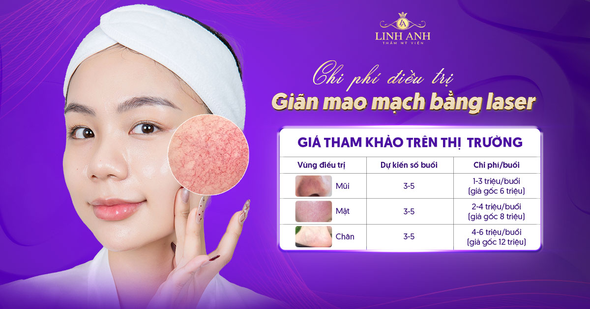chi phí điều trị giãn mao mạch bằng laser