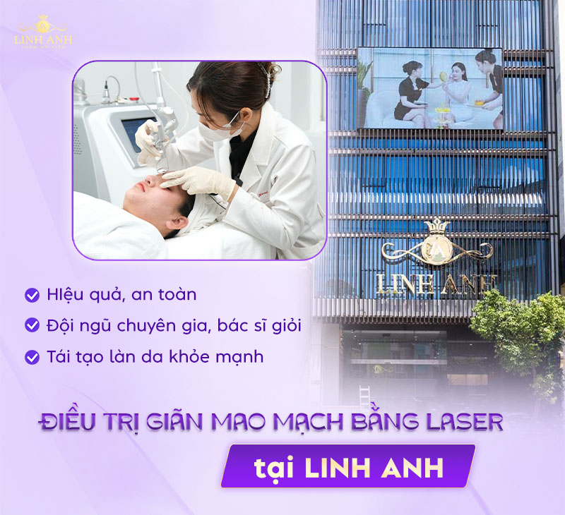 chi phí điều trị giãn mao mạch chi phí điều trị giãn mao mạch
