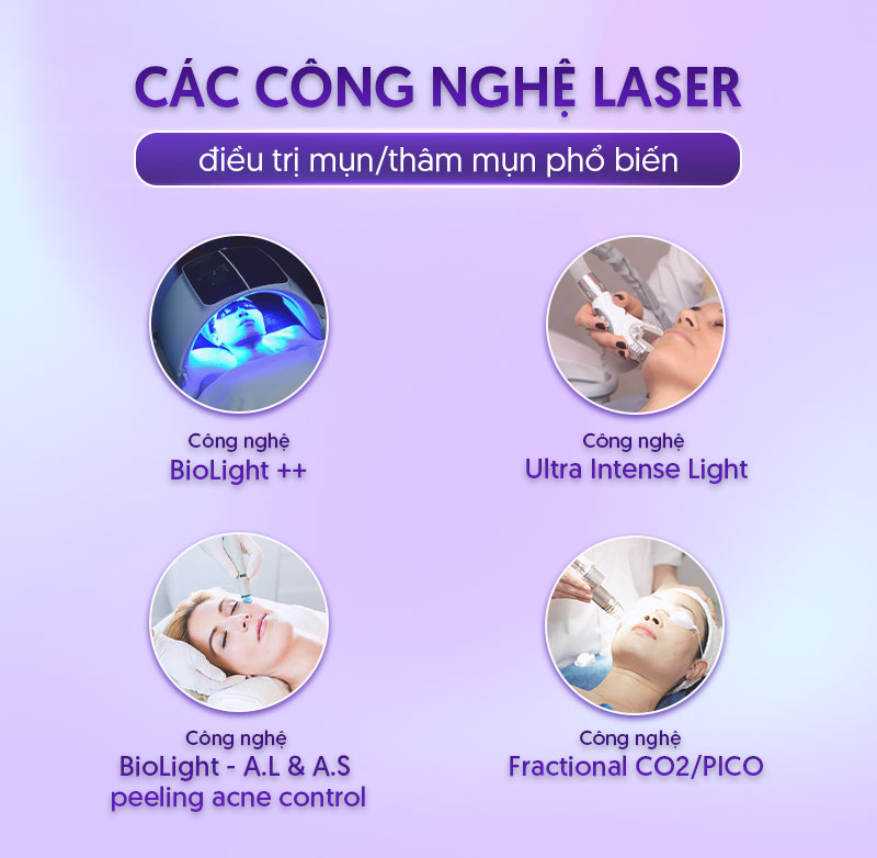 chi phí điều trị mụn bằng laser chi phí điều trị mụn bằng laser