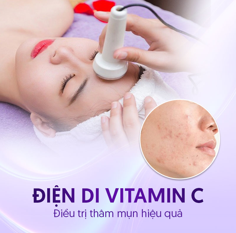 chi phí điều trị thâm mụn chi phí điều trị thâm mụn