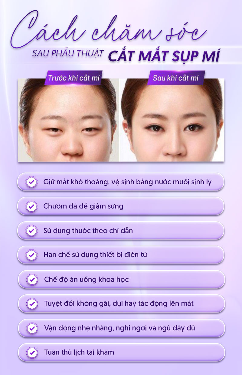 chữa sụp mí mắt bao nhiêu tiền chữa sụp mí mắt bao nhiêu tiền