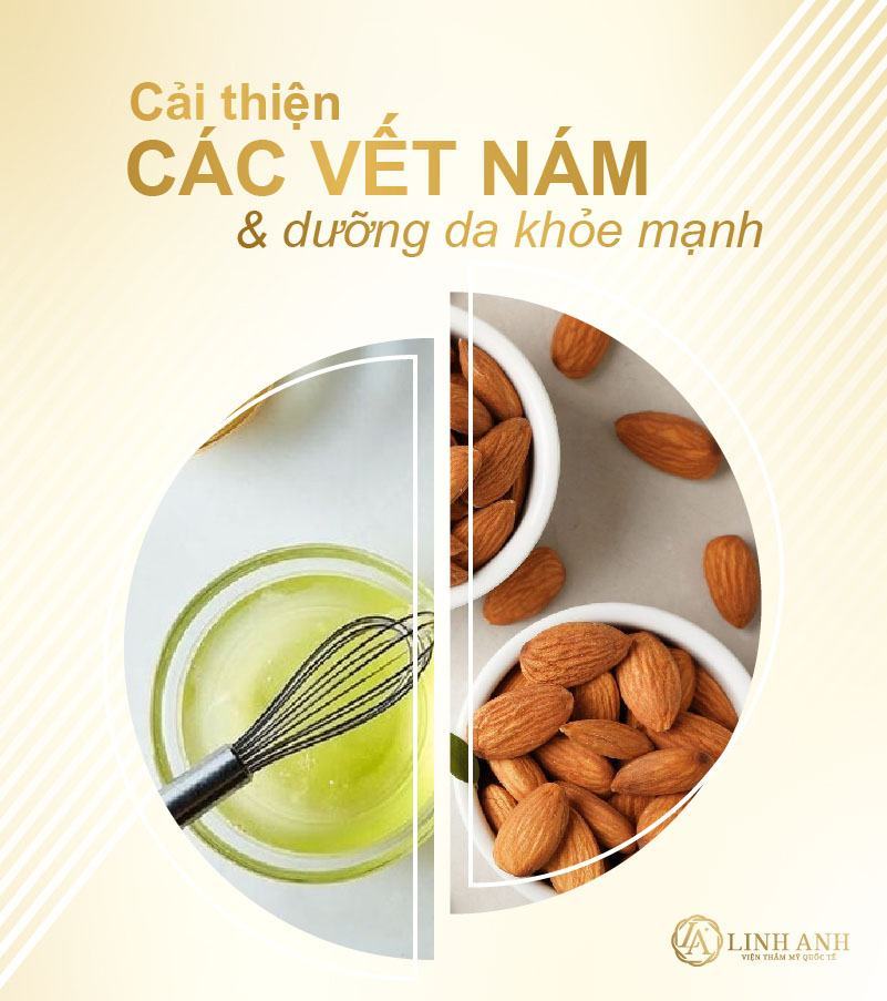 Điều trị nám da bằng thuốc bắc chữa nám bằng thuốc bắc - Viện thẩm mỹ quốc tế Linh Anh
