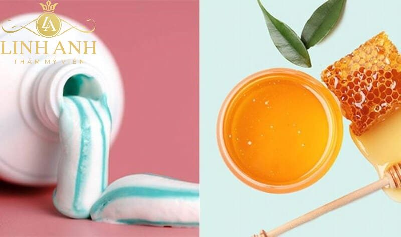 trị tàn nhang bằng kem đánh răng chữa tàn nhang bằng kem đánh răng