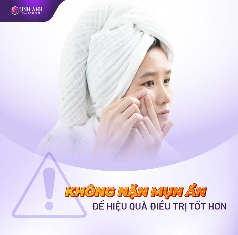 có nên đi nặn mụn ẩn không có nên đi nặn mụn ẩn không
