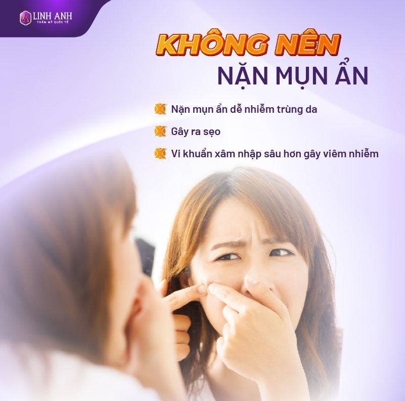 nặn mụn ẩn có nên đi spa nặn mụn ẩn không