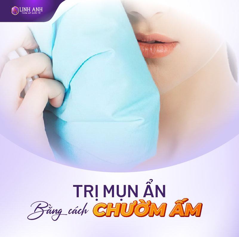 có nên nặn mụn ẩn không có nên nặn mụn ẩn trên trán không
