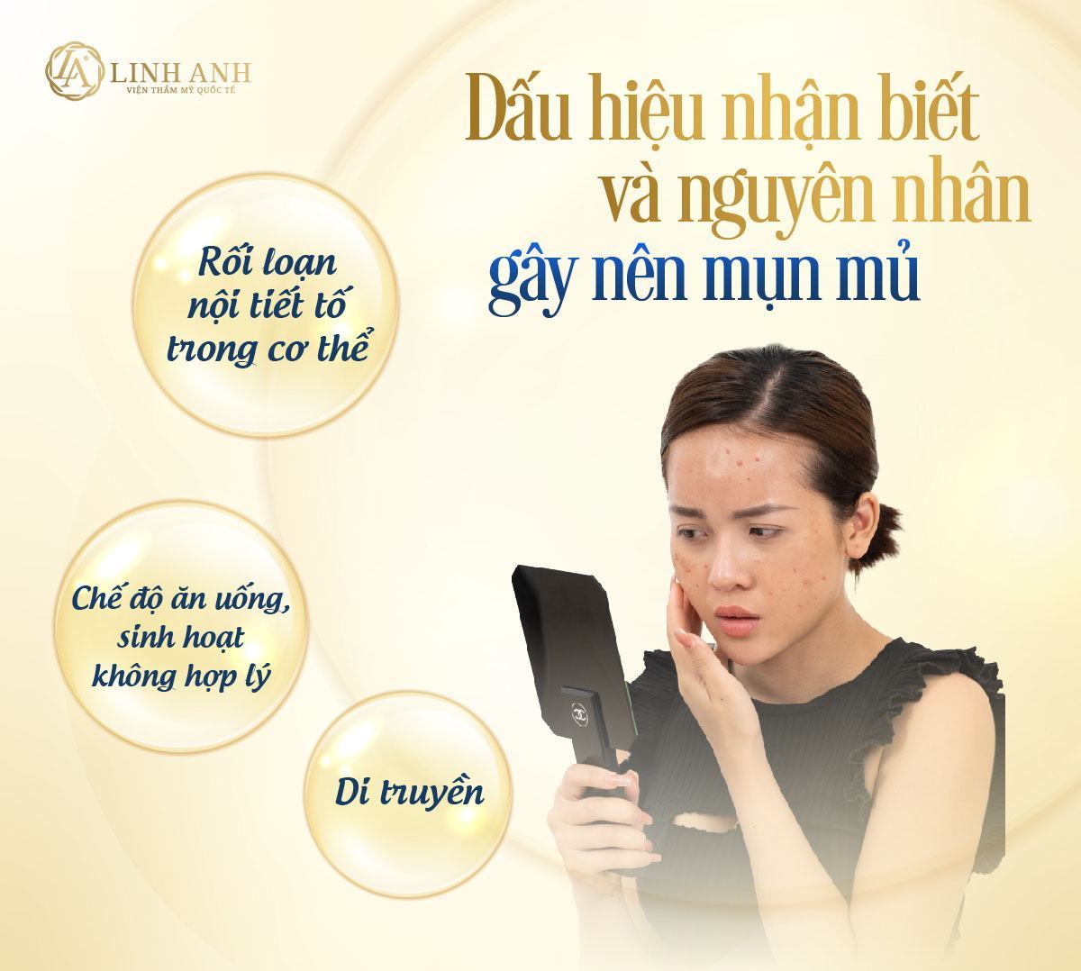 mụn mủ có nên nặn không có nên nặn mụn mủ không - Viện thẩm mỹ quốc tế Linh Anh