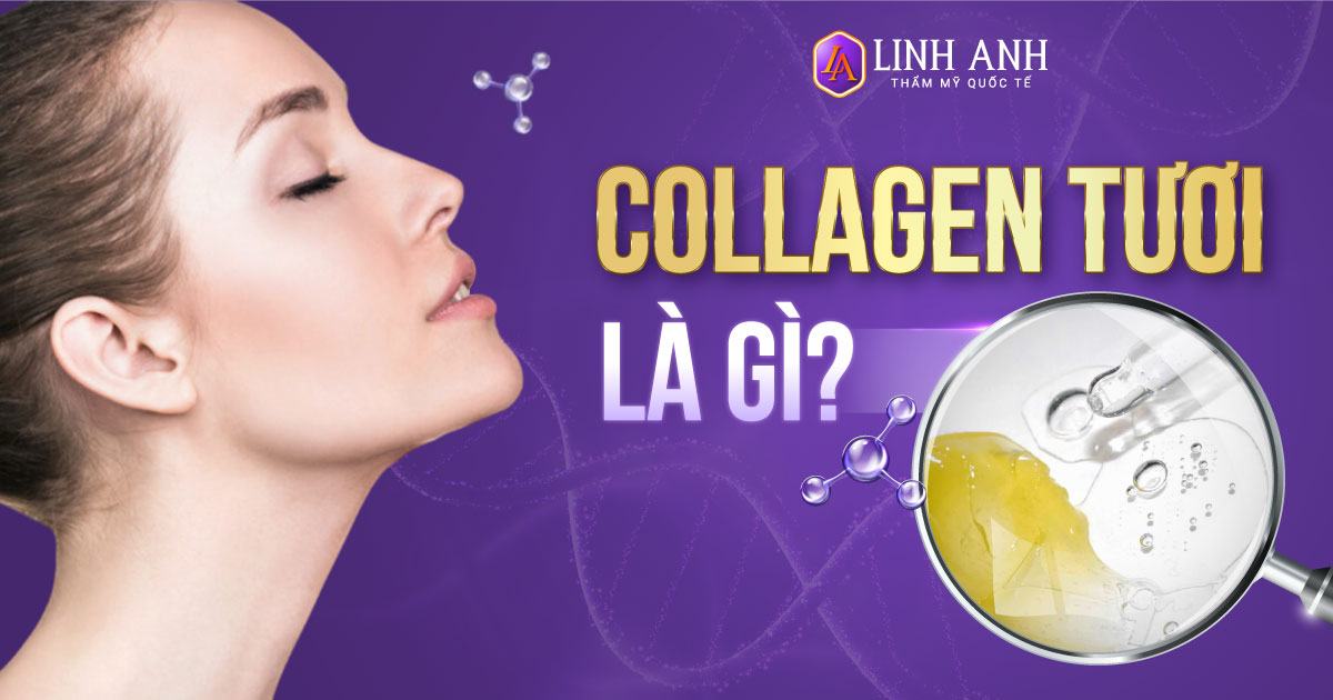 Collagen tươi là gì? Sự khác biệt so với collagen thường