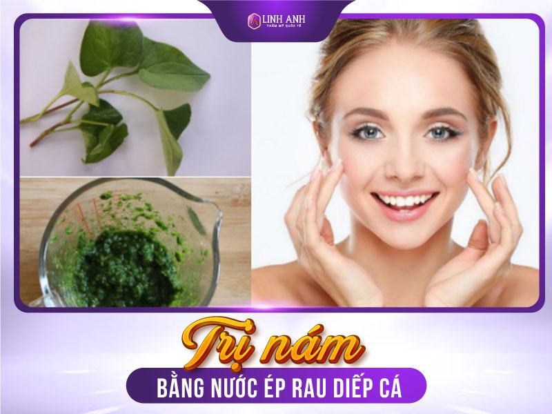 cách trị nám bằng rau diếp cá công thức trị nám bằng rau diếp cá
