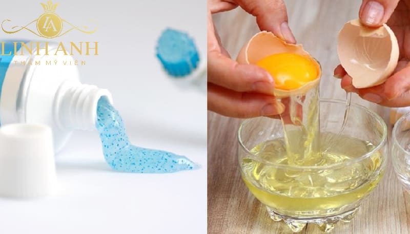 cách trị tàn nhang bằng kem đánh răng công thức trị tàn nhang bằng kem đánh răng
