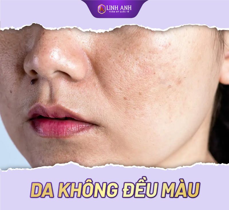 da không đều màu phải làm sao