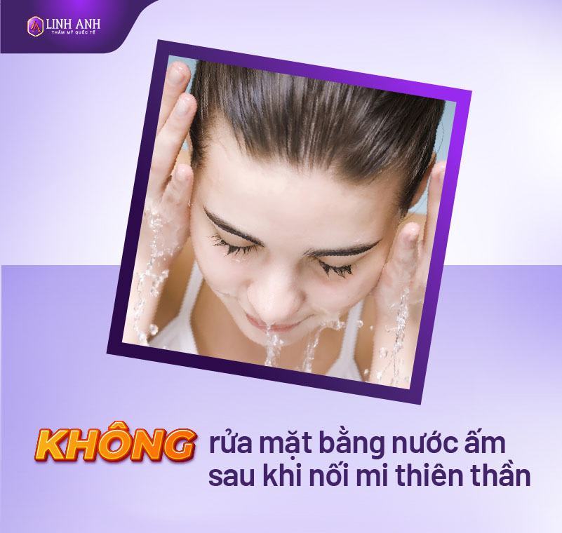 dịch vụ nối mi thiên thần tại Linh Anh - Viện thẩm mỹ quốc tế Linh Anh dịch vụ nối mi thiên thần tại Linh Anh - Viện thẩm mỹ quốc tế Linh Anh