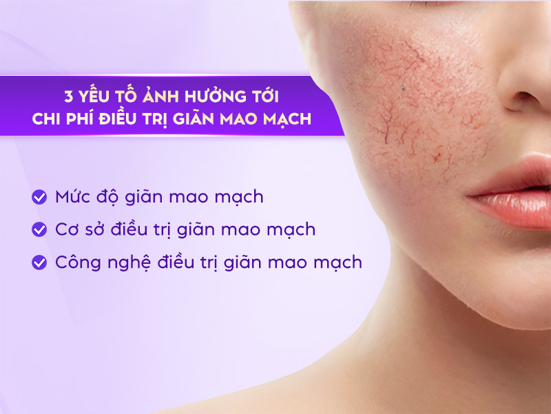 điều trị giãn mao mạch bằng laser điều trị giãn mao mạch bằng laser