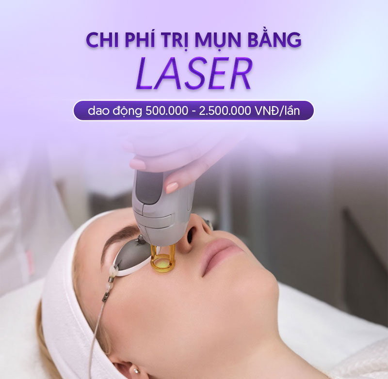 điều trị mụn bằng laser điều trị mụn bằng laser
