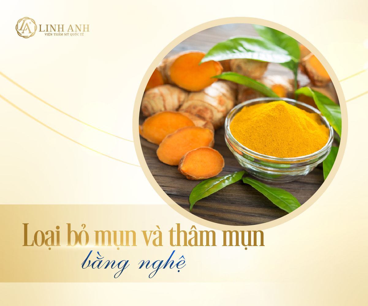 trị mụn thần tốc trong 1 ngày điều trị mụn tại nhà - Viện thẩm mỹ quốc tế Linh Anh