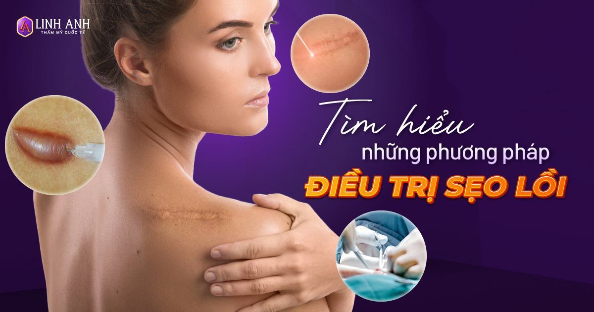 dieu tri seo loi