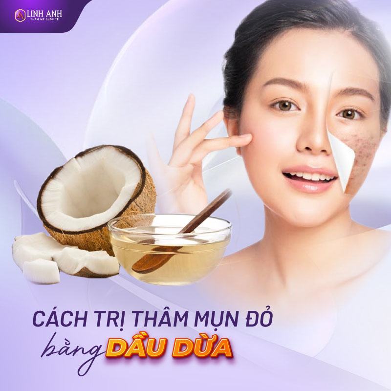 cách trị mụn thâm đỏ điều trị thâm đỏ sau mụn