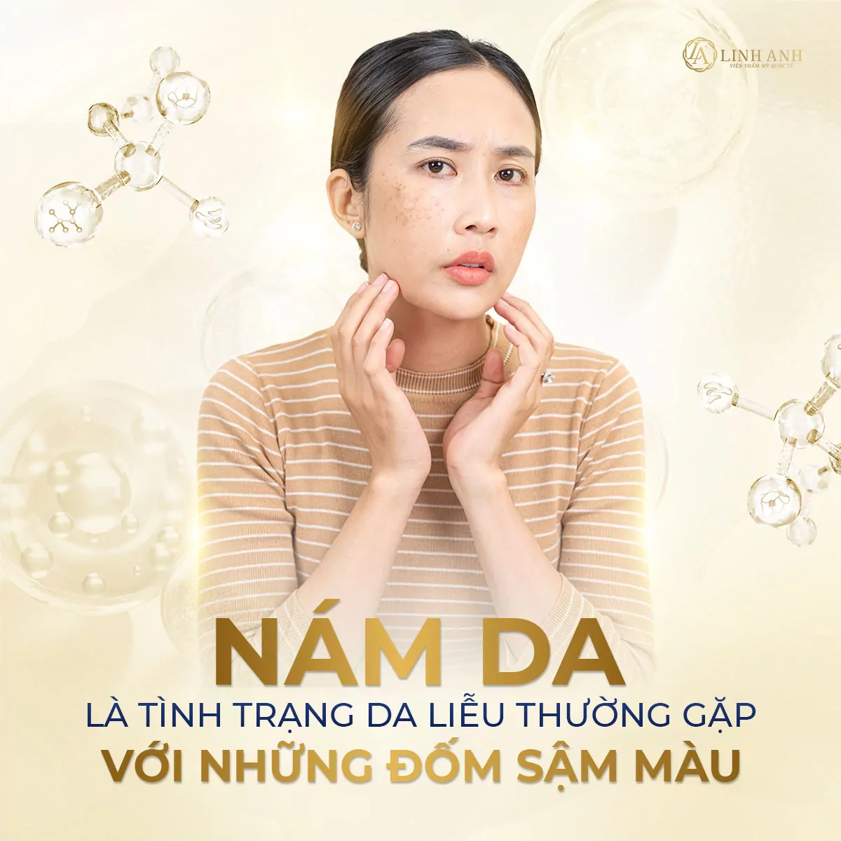 hoạt chất trị nám - Viện thẩm mỹ quốc tế Linh Anh