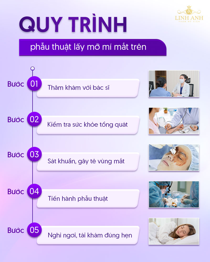 hút mỡ mí mắt trên giá bao nhiêu hút mỡ mí mắt trên giá bao nhiêu