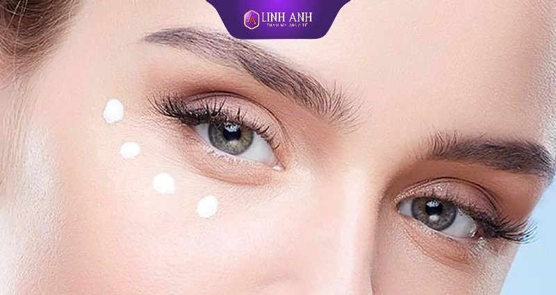 kem dưỡng chống lão hóa mắt
