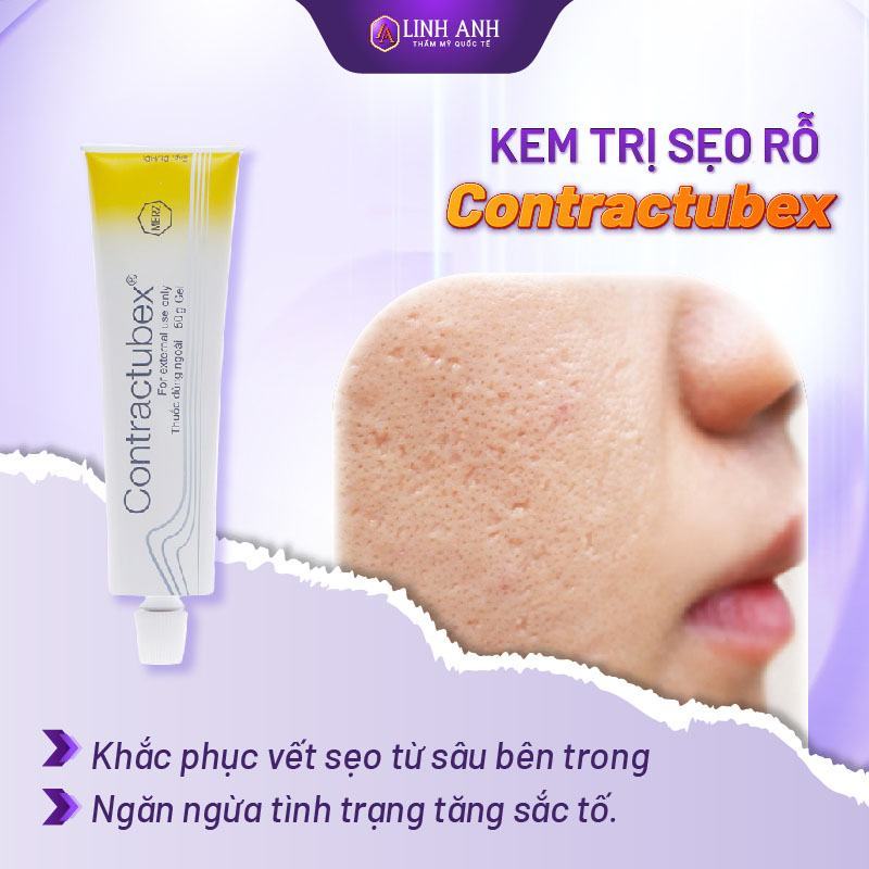 kem hỗ trợ điều trị sẹo rỗ