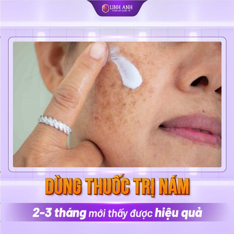 kem trị nám tàn nhang