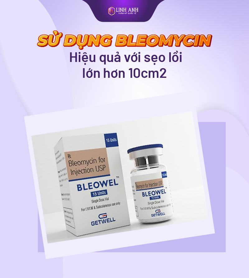 cách trị sẹo lồi tốt kem trị sẹo lồi