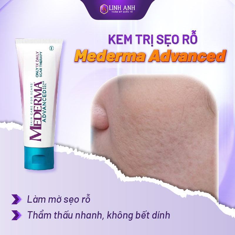 kem trị sẹo rỗ hiệu quả