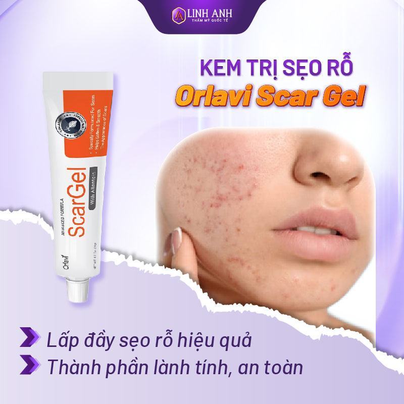 kem trị sẹo rỗ tốt nhất hiện nay