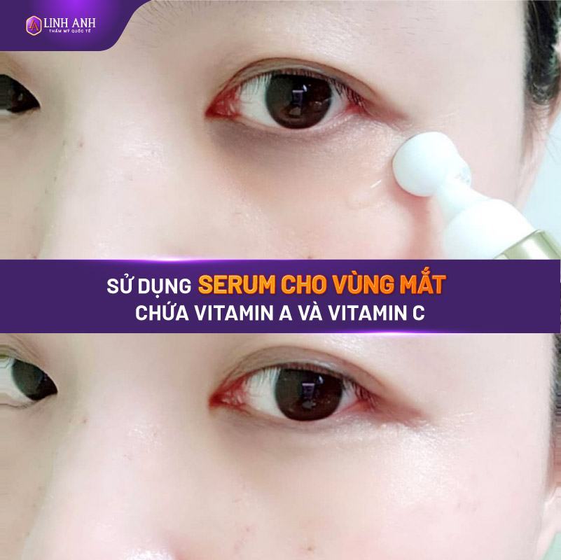 kem trị thâm quầng mắt
