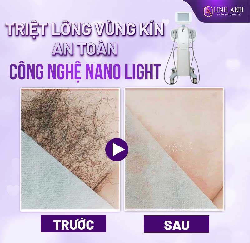thời gian lông vùng kín mọc lại khi nào lông vùng kín mọc lại