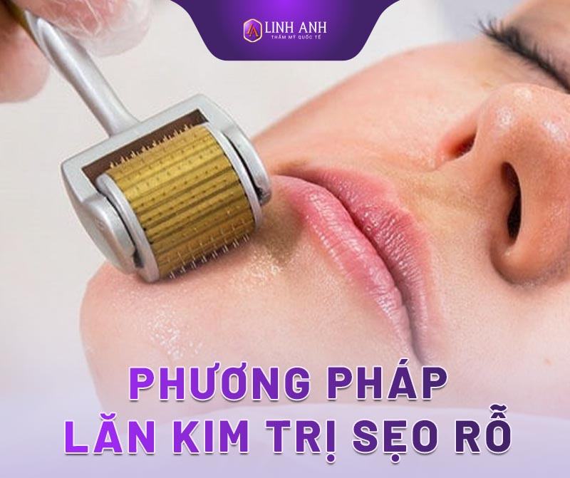 trị sẹo rỗ lâu năm - Thẩm mỹ Quốc tế Linh Anh kinh nghiệm trị sẹo rỗ lâu năm