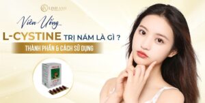 l-cystine trị nám - Viện thẩm mỹ quốc tế Linh Anh