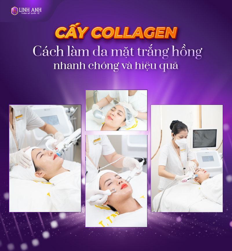 làm da trắng hồng nhanh hiệu quả - Viện thẩm mỹ quốc tế Linh Anh làm da trắng hồng nhanh hiệu quả - Viện thẩm mỹ quốc tế Linh Anh