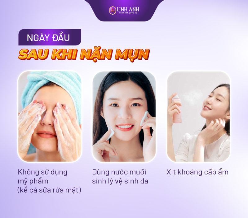 nặn mụn xong nên làm gì - Thẩm mỹ Quốc tế Linh Anh làm gì sau khi nặn mụn
